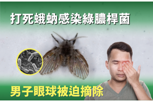 拍打蛾蚋致感染 男子眼球被迫摘除｜蛾蚋防治指南
