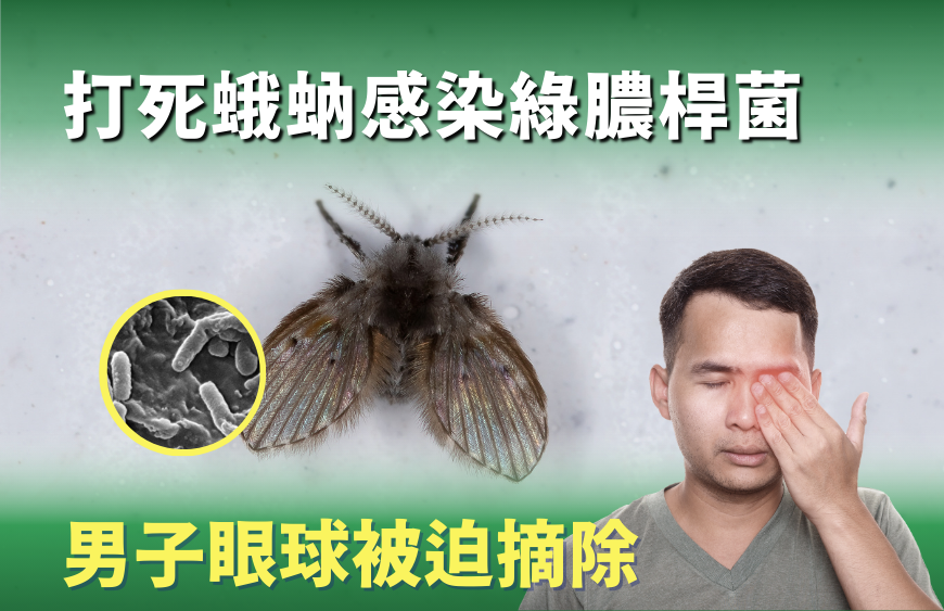 拍打蛾蚋致感染 男子眼球被迫摘除｜蛾蚋防治指南